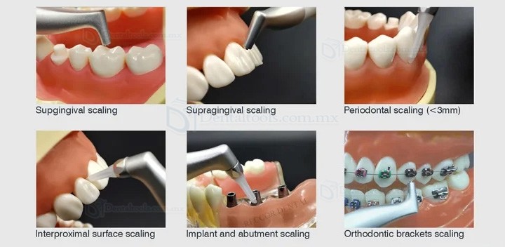 VolDent AirJet 1 Aeropulidor dental para profilaxis supragingival